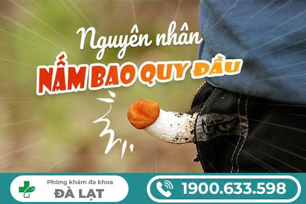 Hình ảnh minh họa